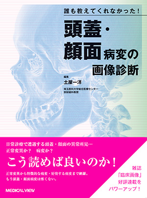 メジカルビュー社｜画像医学・放射線医学｜画像診断の勘ドコロ 新 頭部